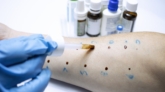 Allergologie3