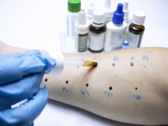 Allergologie3