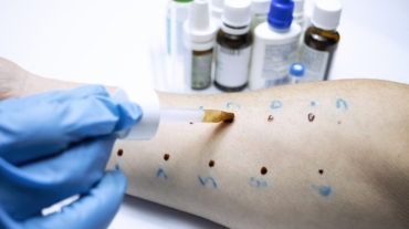 Allergologie3