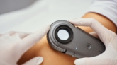 A dermatologist examines the skin. High quality photo