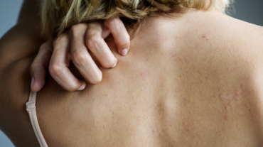 Backside of white woman back pain and ache concept