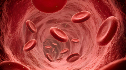 Lupus erythematodes und Hautsymptome